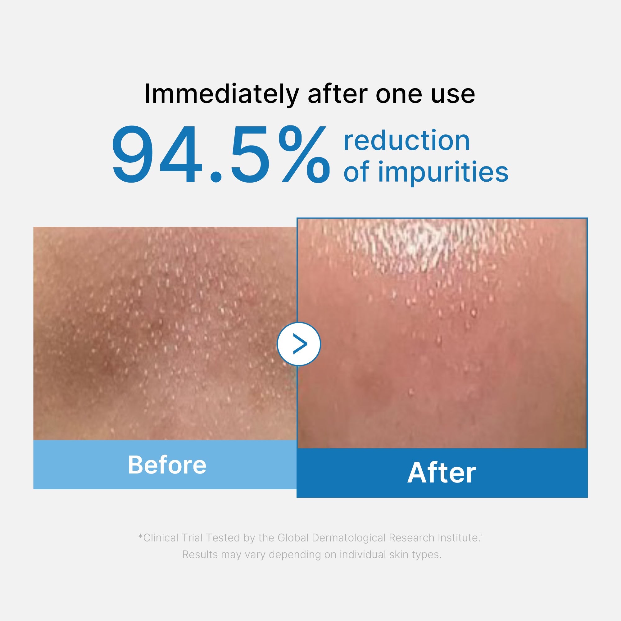 Zero Pore Blackhead Deep Cleansing Oil image 2