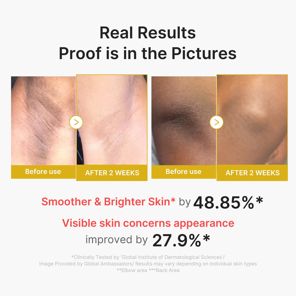 Kojic Acid Turmeric Body Peel Shot image 3