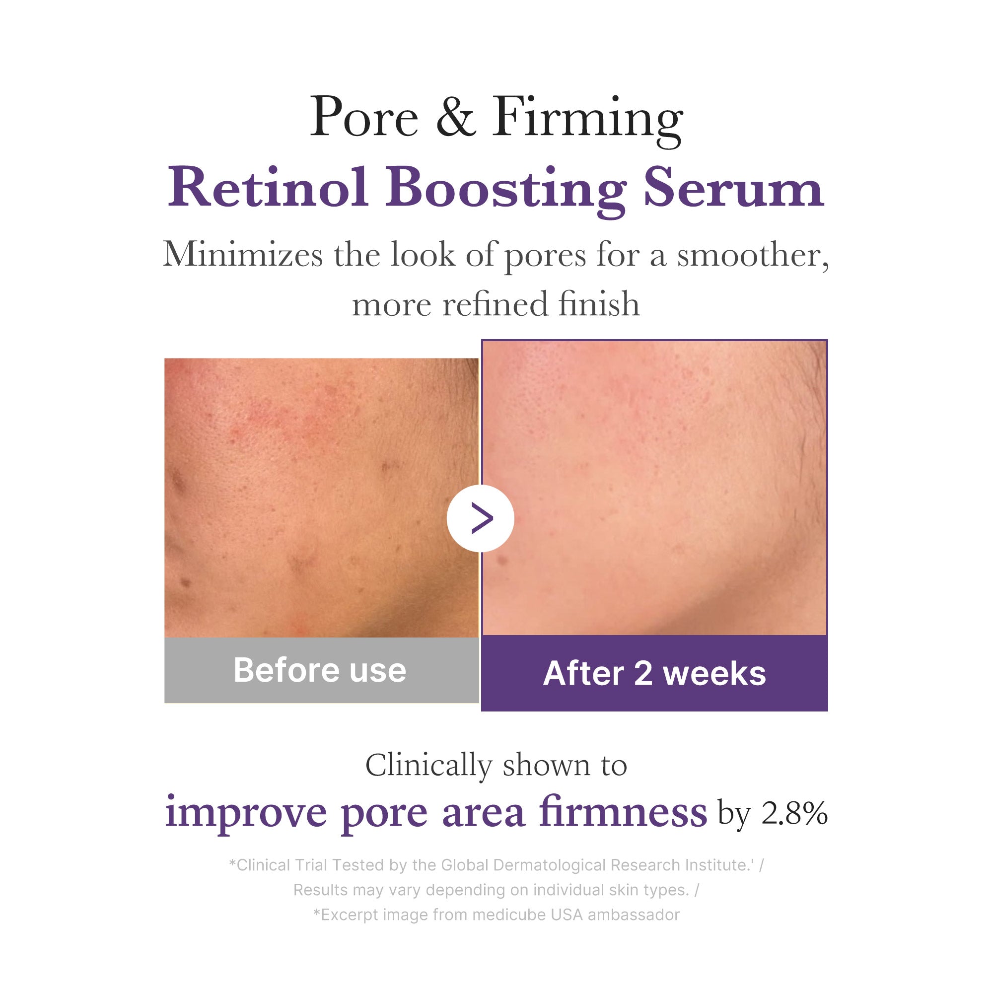 [Subscr.] Retinol NMN Boosting Serum image 4