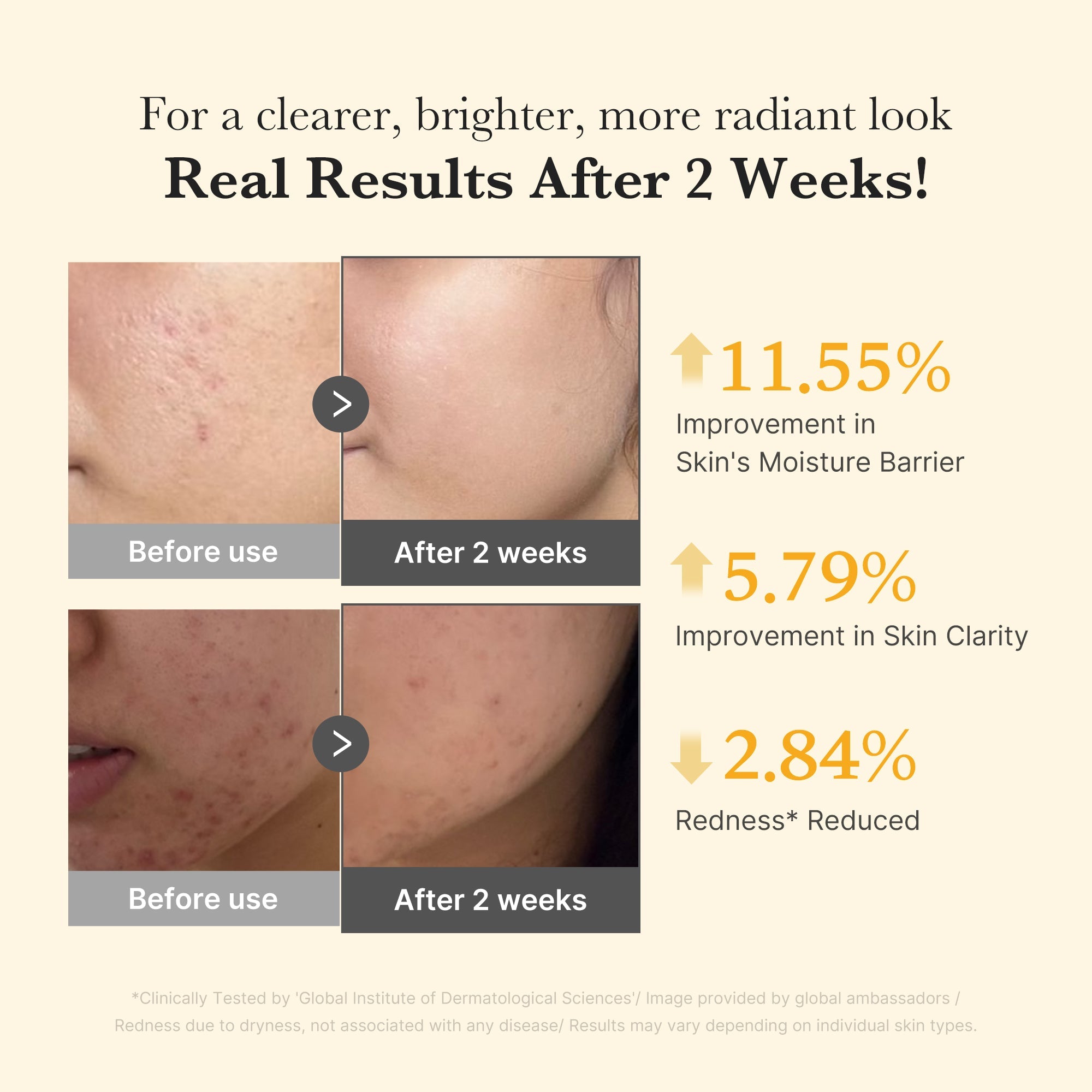 Kojic Acid Turmeric Capsule Serum image 4