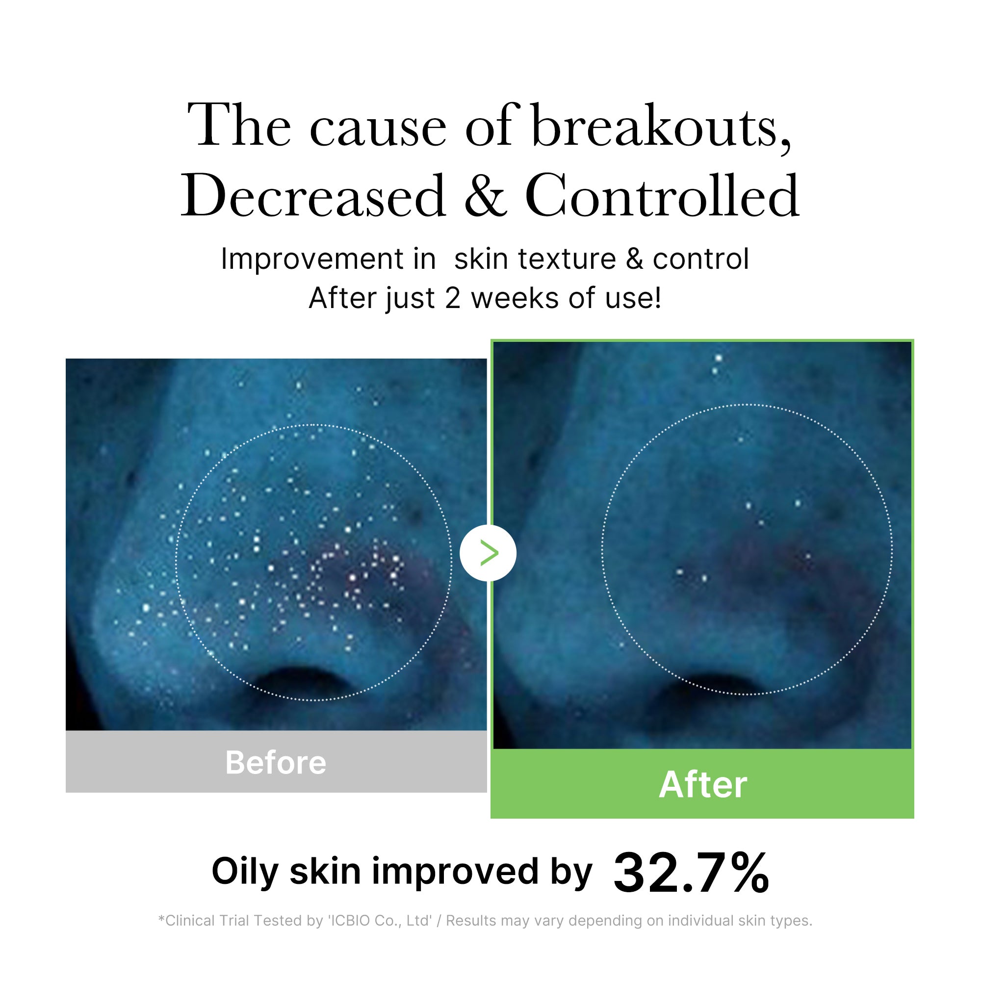 [GIFT] Exosome Cica Calming Toner image 4
