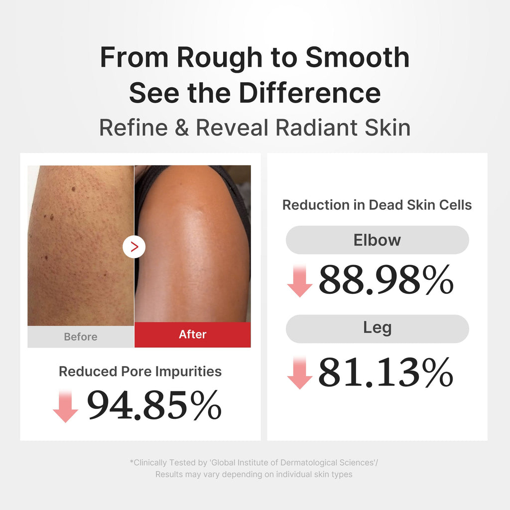 [GIFT] Hypochlorous Acid Rice Body Peel Shot image 4