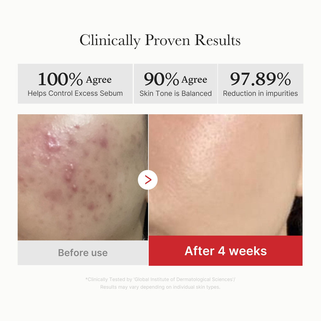 [GIFT] Red Succinic Acid Panthenol Pads image 4