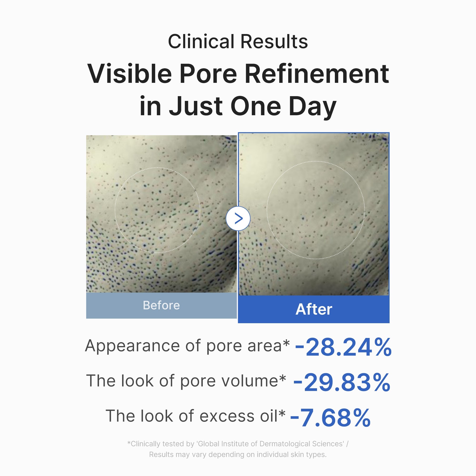[Subscr.] Zero Pore One-day Peptide Serum image 6