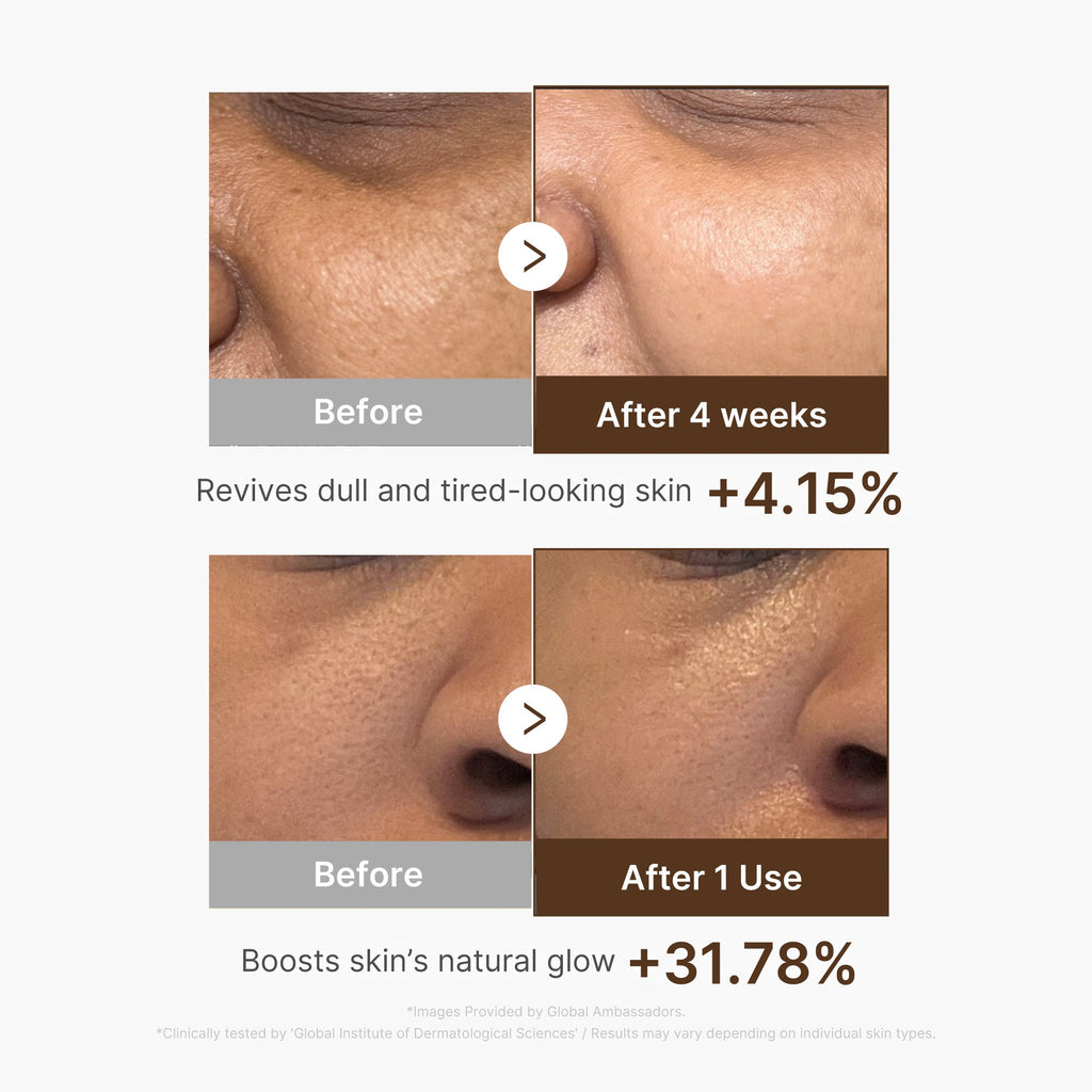 Deep Vitamin C Capsule Serum image 5