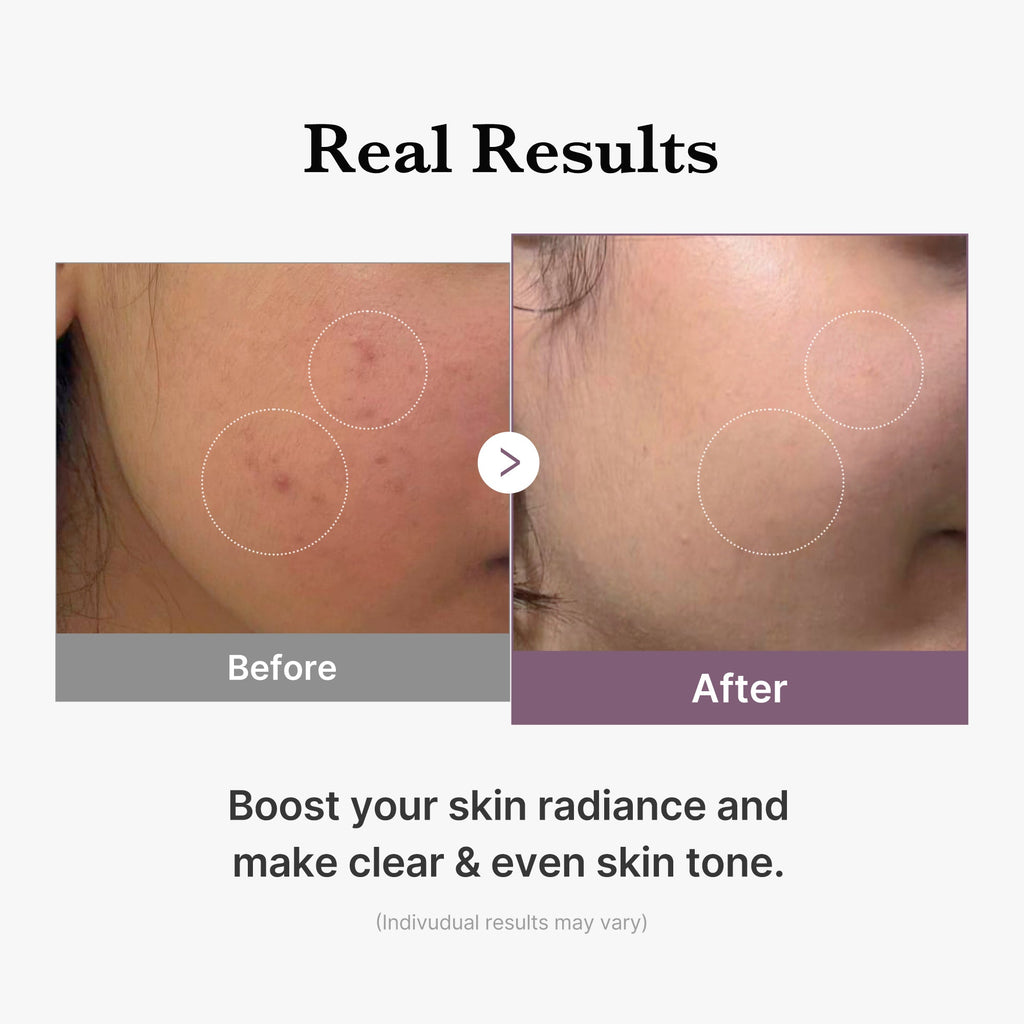 [GIFT] AGE-R Glutathione Glow Milk Toner image 5