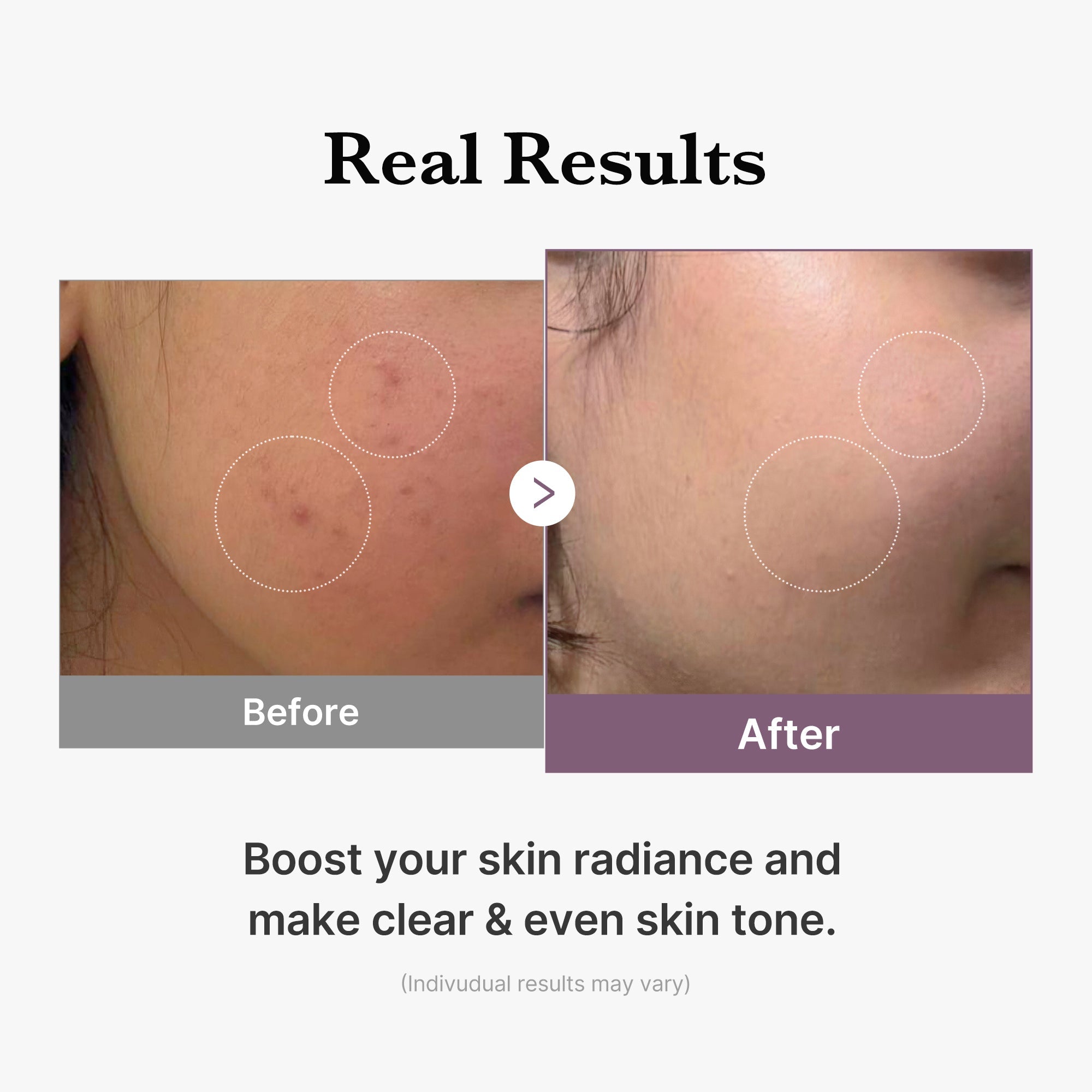 [GIFT] AGE-R Glutathione Glow Milk Toner image 5