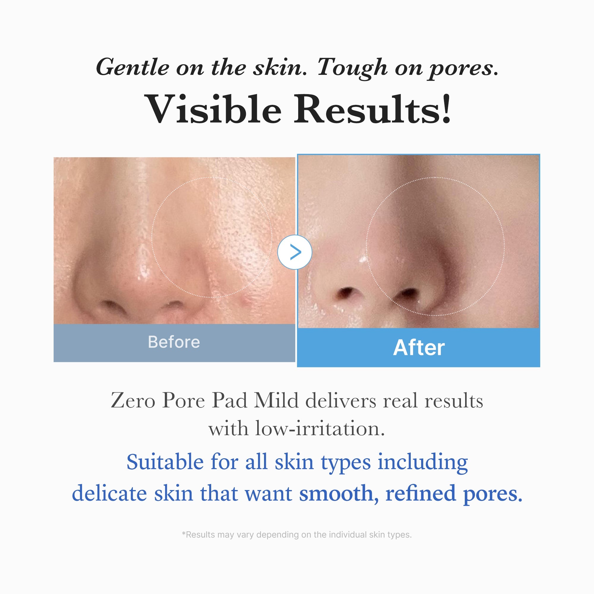 [Subscr.] Zero Pore Madecassoside Pads (Mild) image 5
