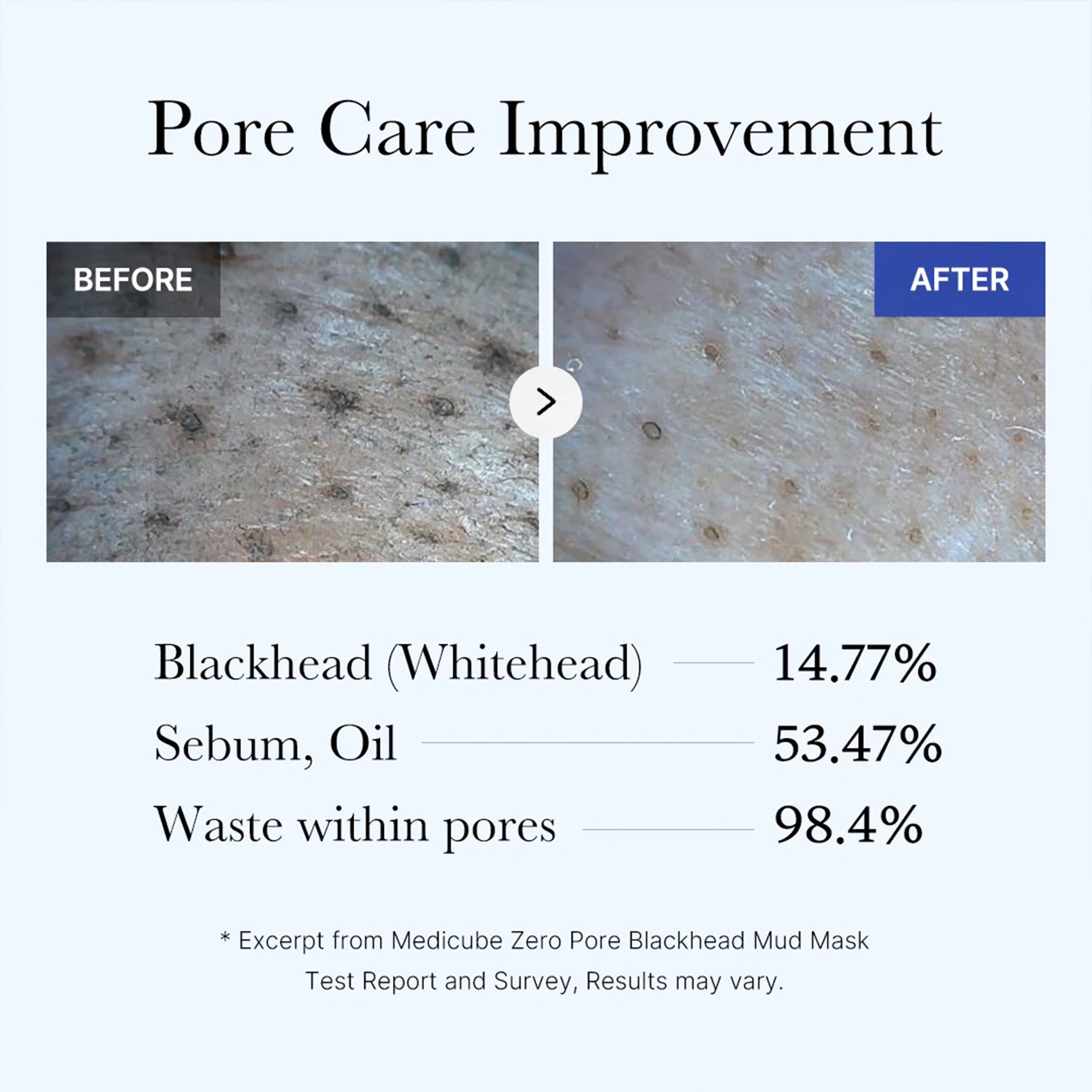 Zero Pore Blackhead Mud Mask image 5