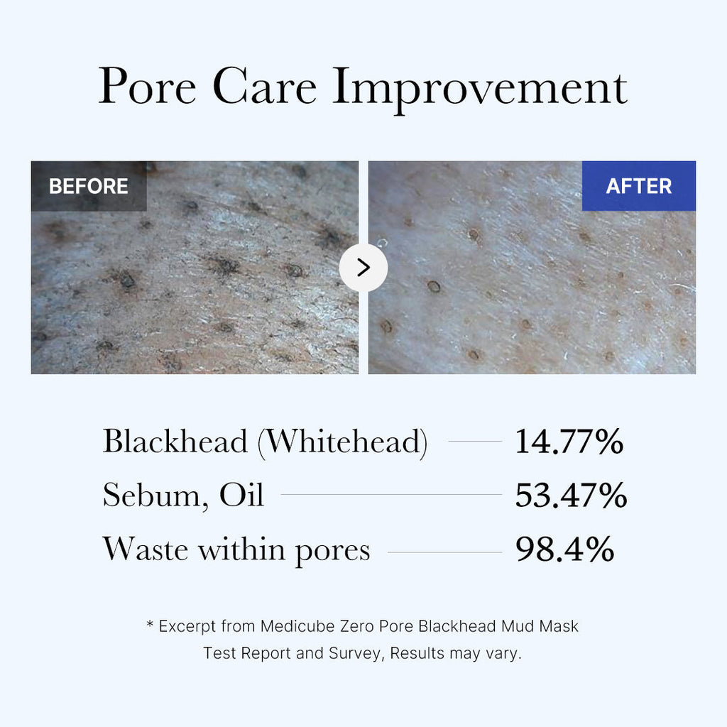 [GIFT] Zero Pore Blackhead Mud Mask image 5