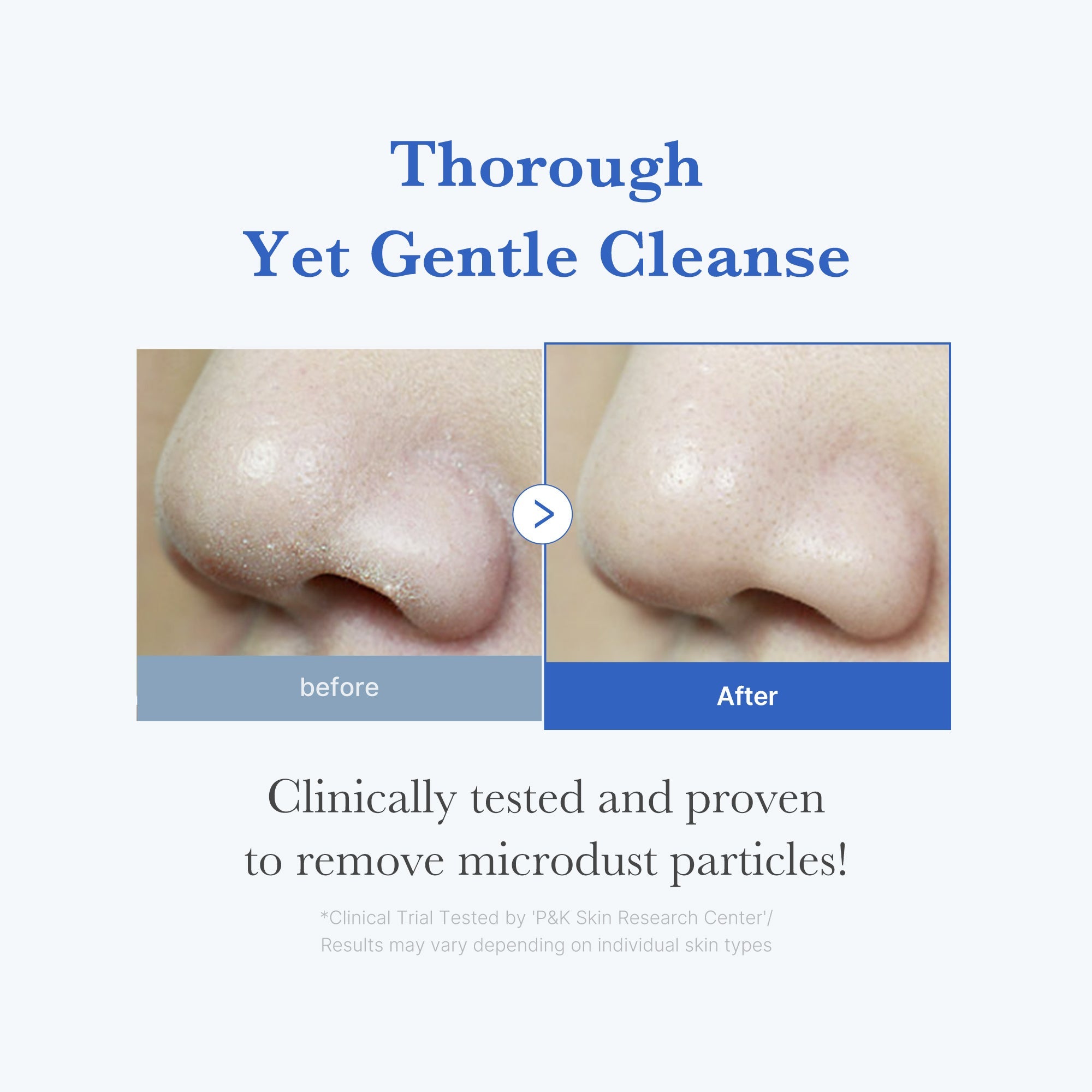 [GIFT] Zero Foam Cleanser image 3