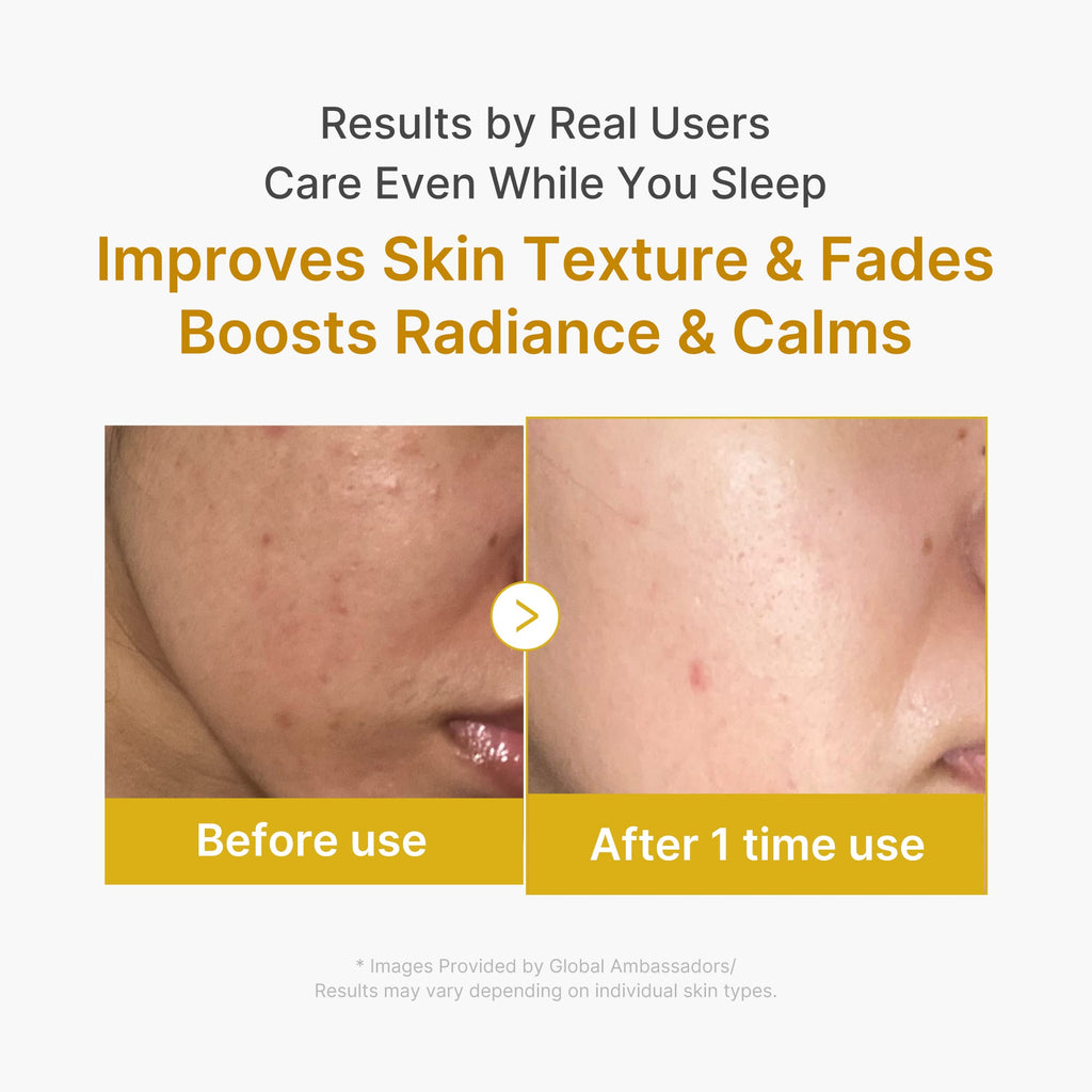 [GIFT] Kojic Acid Turmeric Overnight Wrapping Mask image 6