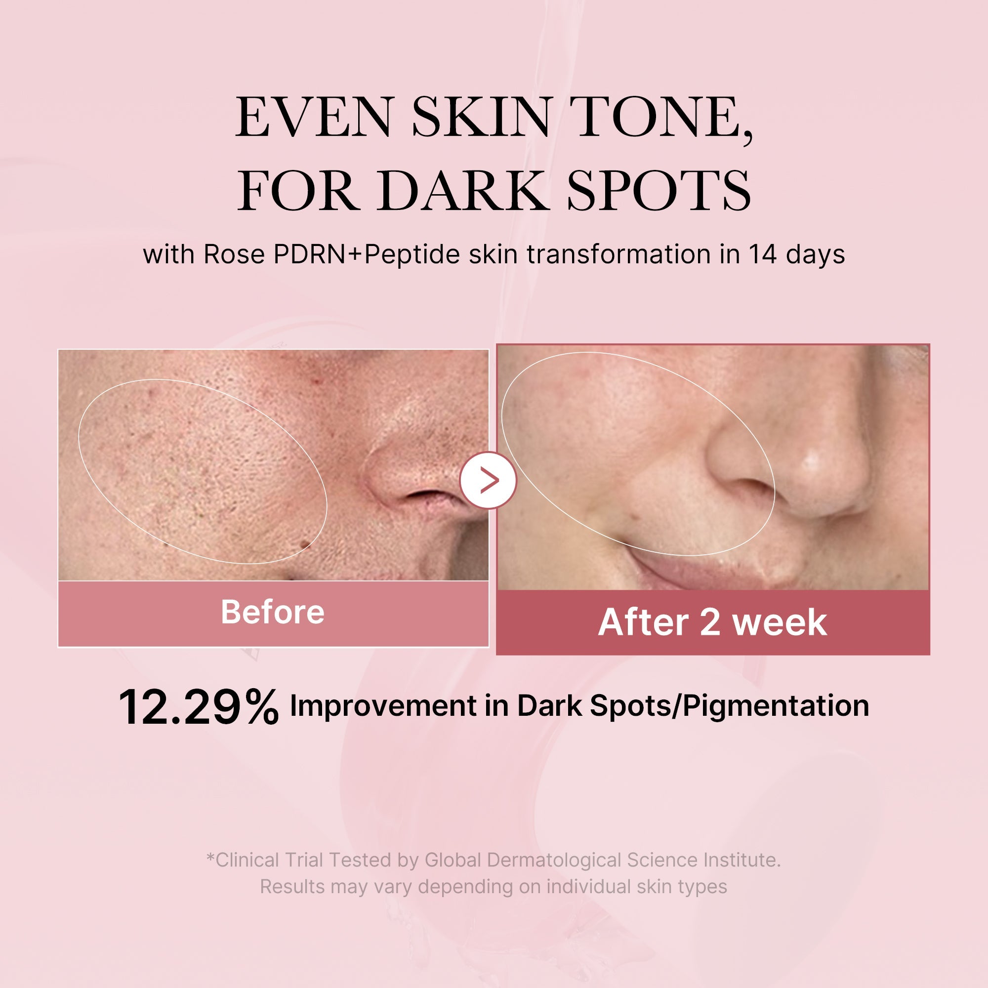 [GIFT] PDRN Pink Peptide Toner image 2