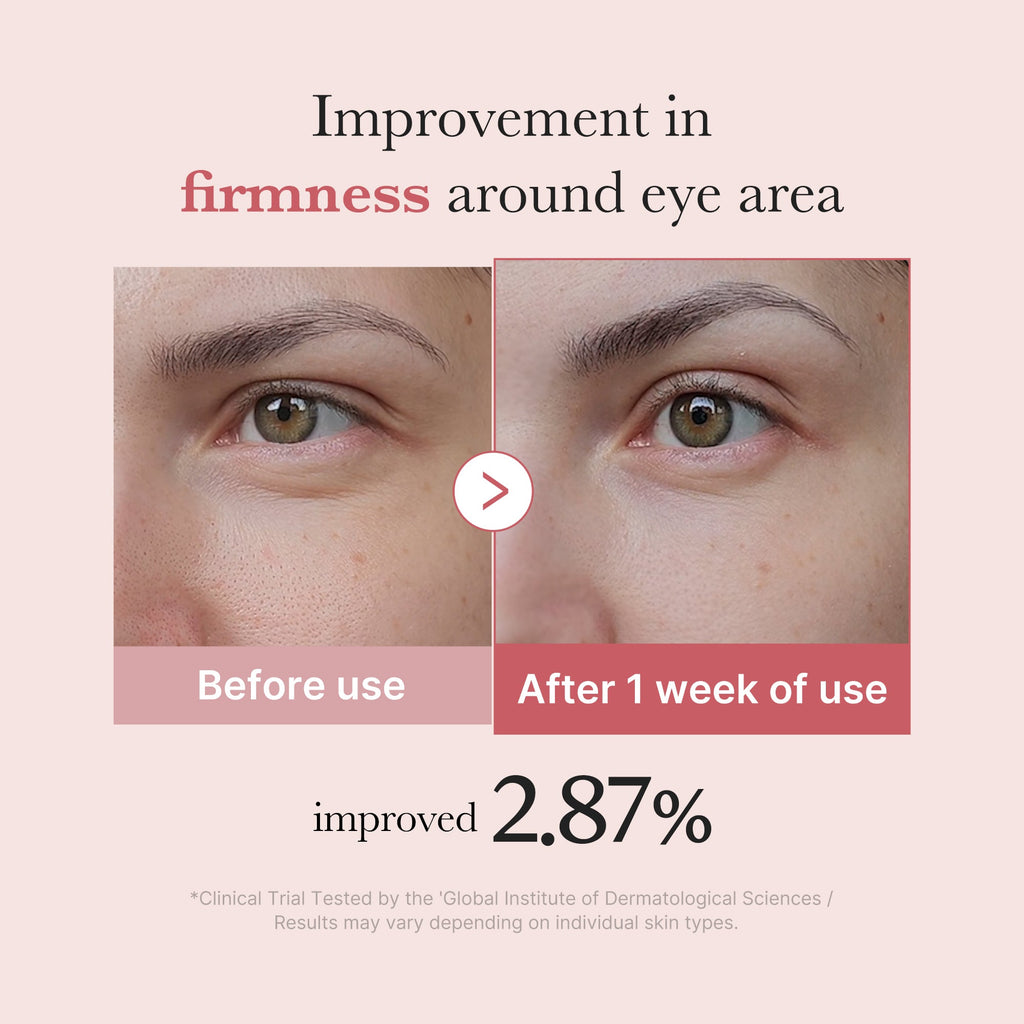 PDRN Pink Peptide Eye Cream image 4