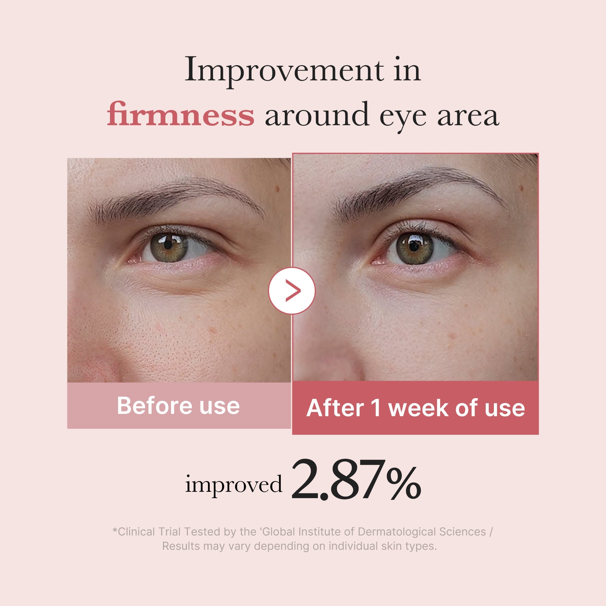 [GIFT] PDRN Pink Peptide Eye Cream image 4