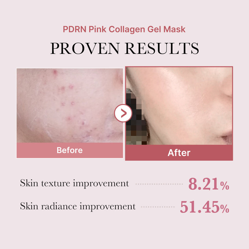 Salmon PDRN Pink Collagen Jelly Gel Mask image 6