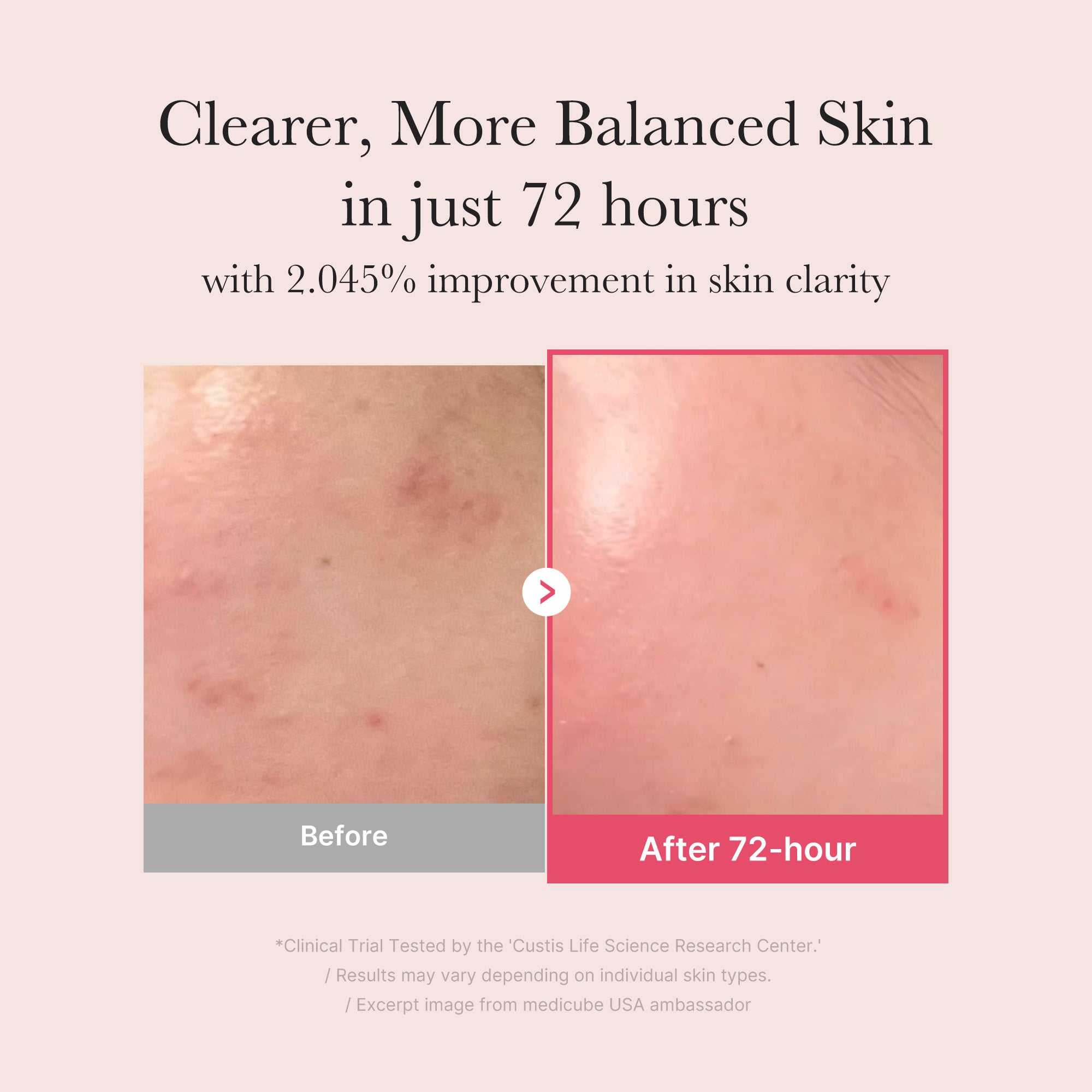 [GIFT] TXA Niacinamide Serum image 3