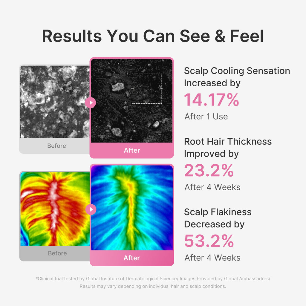 Rosemary PDRN Scalp Serum image 5