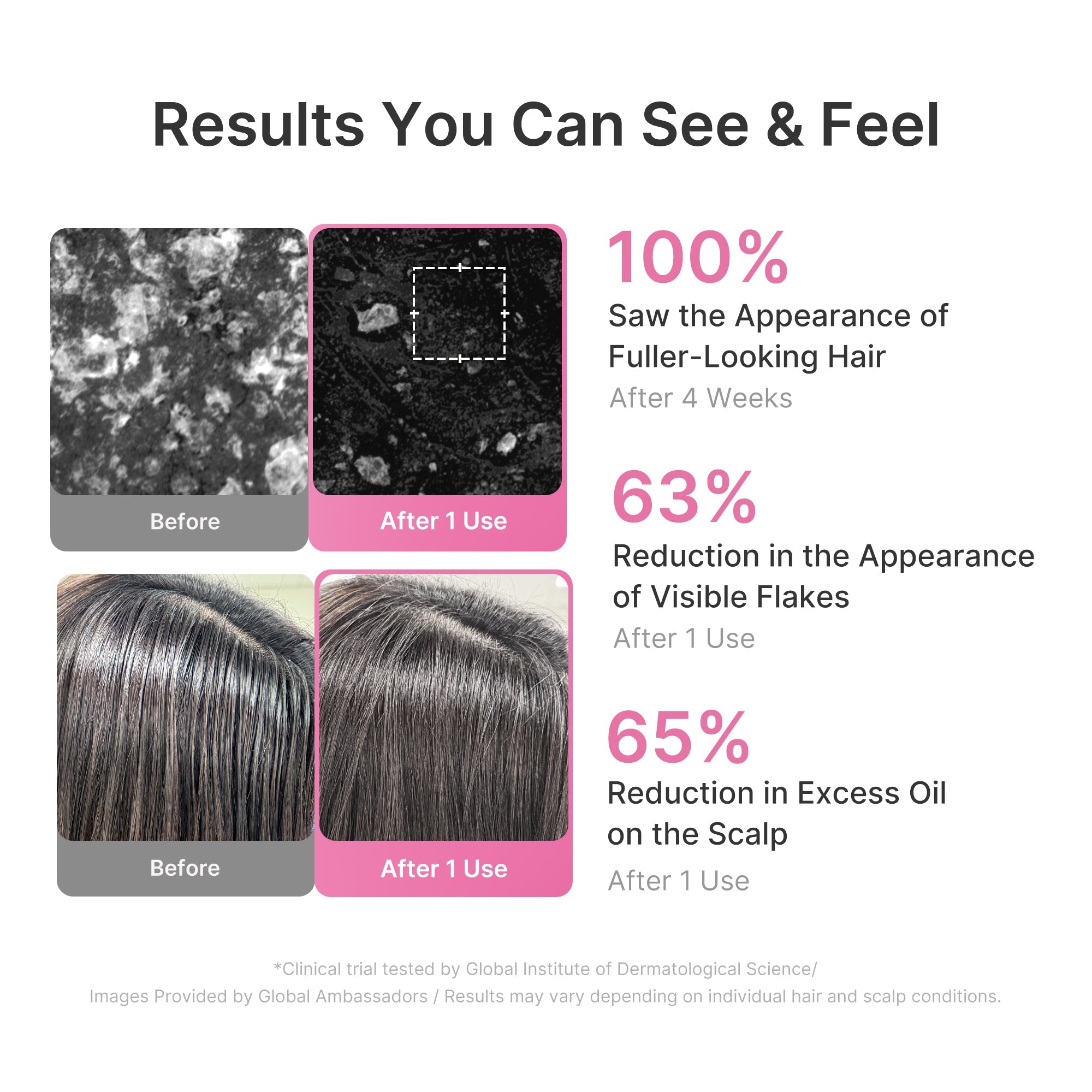 Rosemary PDRN Cooling Thickening Shampoo image 5